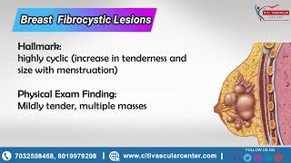 Fibrocystic Breast Causes Signs I Breast Fibroadenoma [upl. by Aikenat]