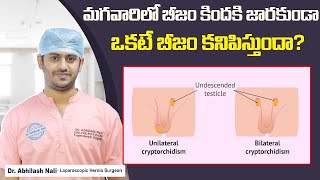 What is Undescended Testicle and How to Treat That  Cryptorchidism Causes  Dr Abhilash Nali [upl. by Olegnaleahcim]