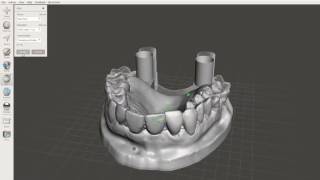 Creating supports in MeshMixer [upl. by Esbenshade]