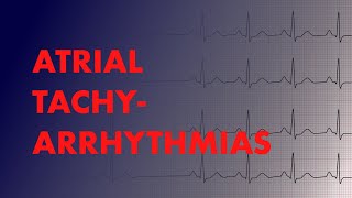 Atrial Arrhythmias Afib vs AFlutter vs Focal vs Multifocal Atrial Tachycardia  MEDZCOOL [upl. by Eymaj]