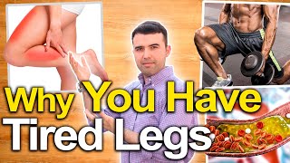 TIRED LEGS Are Warning You  Tired Legs and Leg Pain Causes Natural Treatments And How To Fix Them [upl. by Trinity]