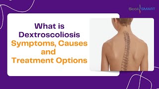 Understanding Dextroscoliosis Symptoms Causes and Treatment Options Dextroscoliosis scoliosis [upl. by Christoper]