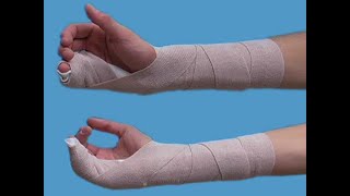 Ulnar Gutter Splint [upl. by Lona467]