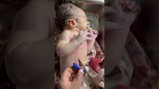 Cut umblical cords Baby born shorts youtubeshorts bornebaby newbornbaby viral [upl. by Phelps]