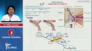 HERNIAS GENERALIDADES INGUINAL CRURAL UMBILICAL EPIGÁSTRICA ESPECIALES  2024 QX MEDIC [upl. by Hubey]