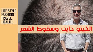 علاج تساقط الشعر للنساء و الرجال مع الكيتو  اسبابه و وطرق علاجه 2020 [upl. by Moriah]