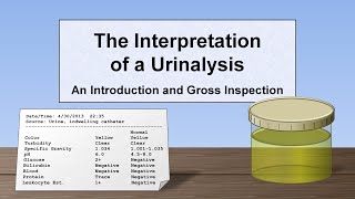 Interpretation of the Urinalysis Part 1  Introduction and Inspection [upl. by Lock]