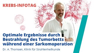 Optimale Ergebnisse durch Bestrahlung des Tumorbetts während einer Sarkomoperation [upl. by Nnyrb]