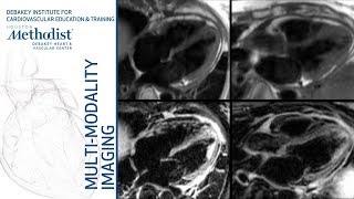 Pericardial Diseases CTMRIEchoComplementary or Redundant Shah MD Nabi MD January 22 2019 [upl. by Rim]