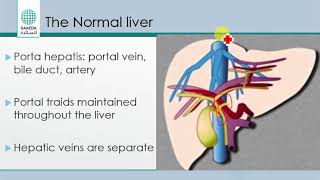 liver sonography [upl. by Peg]