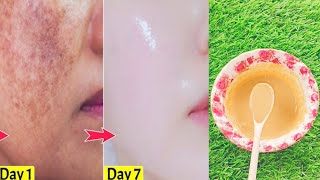 Winter face pack for daily use for dry skin  Winter multani mitti face pack for daily use benefits [upl. by Ailem242]