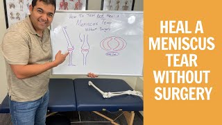 How To Test amp Heal A Meniscus Tear Without Surgery [upl. by Erot830]