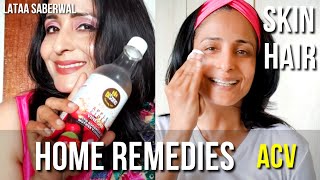 Top 3 Apple Cider Vinegar Benefits  Removes Pimples Acne amp Dandruff Frizzy hair with DISANO ACV [upl. by Eachern]