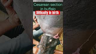 Difficulty in birth l Dystocia l Cesarean section l Dr Umar Khan [upl. by Nevsa]