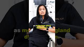 Meibomian gland dysfunction  Dr Krishna poojita  eye meibomian dryeyesyndrome dryeyetreatment [upl. by Ciro]