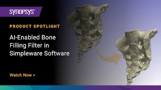 AIEnabled Bone Filling Filter in Simpleware Software [upl. by Natika]