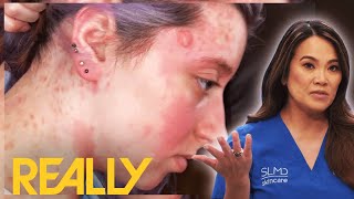 Dr Lee Helps Patient Whos Been Tackling Mastocytosis Her Whole Life  Dr Pimple Popper [upl. by Sig]