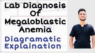 Lab Diagnosis of Megaloblastic anemia vitB12 amp Folate deficiency anemia Megaloblasticanaemia [upl. by Nacnud441]