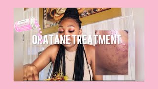 My Oratane journeyHow I cleared my acneamp side effects Clear skin South African YouTuber [upl. by Noicpecnoc238]