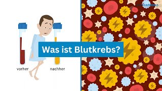 Was ist LeukämieBlutkrebs Symptome Diagnose Behandlungen [upl. by Jessie940]