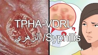 تحاليل الكشف عن الزهري  السفلس TPHAVDRL Syphilis [upl. by Nylirehs]