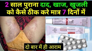 2 साल पुराने दाद खाज खुजली को कैसे ठीक करें  fungal infection in private parts  khujli ki dawa [upl. by Nomelif259]