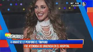 Anahí sufre perforación de tímpano durante ensayos de RBD  El Chismorreo [upl. by Oralie18]