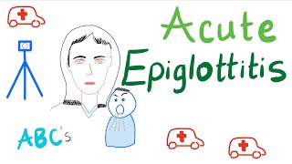 Acute Epiglottitis  Causes Symptoms Diagnosis and Management [upl. by Hamirak209]