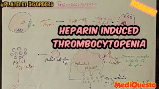 Heparin Induced Thrombocytopenia PlateletDisorders Hematology RobbinsPathology [upl. by Milson191]