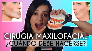 Cirugia Maxilofacial 😰 ¿Cuándo debe hacerse 🦷 ¿Cómo saber si la necesito 🤔  Odontología Láser [upl. by Elohc]