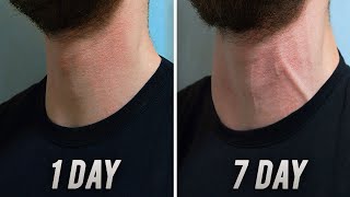 Big Neck in 7 DAYS   Home Exercise [upl. by Notgnilliw]