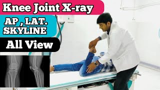 knee joint xray position  AP Lat Skyline view  Skyline view Xray Position [upl. by Ahsekram]