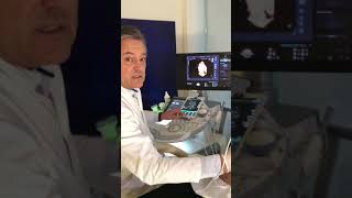 Prof Breymann and Lumify in Obstetrics [upl. by Luckett]