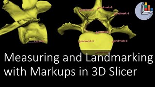 Measuring and Landmarking 3D Data with the 3D Slicer Markups Module [upl. by Affrica182]