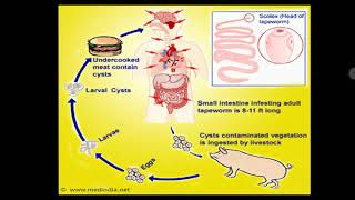 Neurocysticercosis [upl. by Ykcaj859]