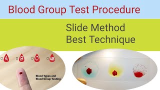 Blood Grouping by Slide Method  Blood Group test procedure [upl. by Dorehs]