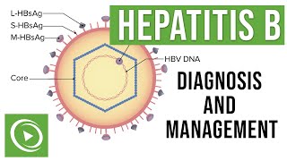 Hepatitis B Overview Clinical Presentation Diagnosis and Management  Lecturio [upl. by Atrebor461]