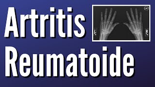 Artritis Reumatoide [upl. by Bubalo]