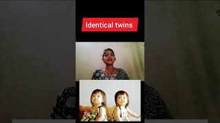 monochorionoc Diamniotic twins pregnancy kya hoti hai identical twins pregnancy dizygotic twins preg [upl. by Andeee]