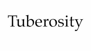 How to Pronounce Tuberosity [upl. by Alieka]