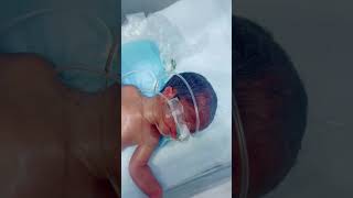 Incubator Care In Nursery 🤩 babies neonatal viralvideo viralshorts reels foryou [upl. by Thamos]