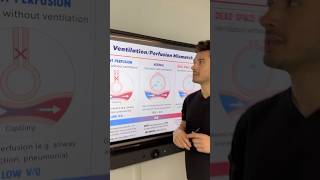 VQ Mismatch in 60s from my Pulmonology Guide📘medschool medstudent usmle usmlestep1 step1 [upl. by Dronski]