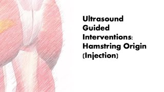 ultrasound Guided Interventions Hamstring Origin Injection fyp sport sports sportsmedicine [upl. by Aeki]