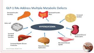 GLP 1 RAs Real World Patient Care Strategies for Type 2 [upl. by Francois392]