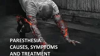 Paresthesia Causes Symptoms and Treatment [upl. by Radley712]