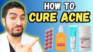 99 Overlook These Effective Acne Treatments – 2024 Guide [upl. by Alister]