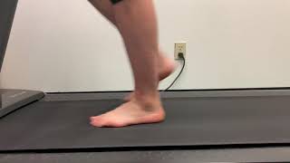 Failure of Forefoot rocker and compensatory unstable Midtarsal joint [upl. by Christal]