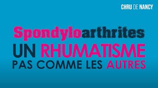 FACEBOOK LIVE Spondyloarthrite  un rhumatisme pas comme les autres [upl. by Felita]