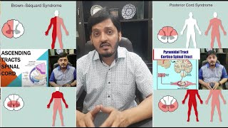 Spinal Cord Injuries  NeuroAnatomy  Rules Facts Clinical Features  Muhammad Kamran Ameer [upl. by Nednarb534]