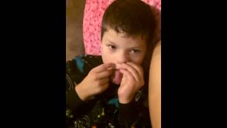 Angelman Syndrome  Constantly rubbing his face  side effects [upl. by Aihsyn352]